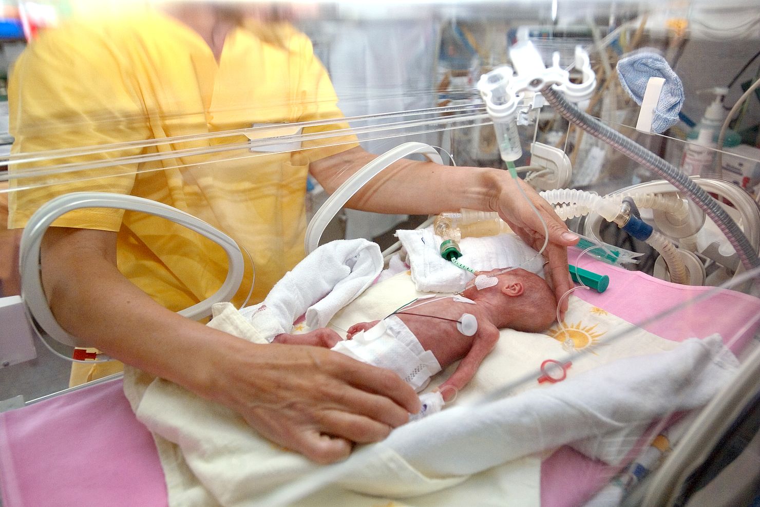 Krankenschwester versorgt ein Frühgeborenes im Inkubator